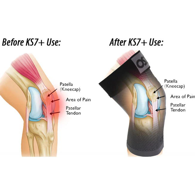 OS1st KS7+ Unisex Adjustable Performance Single Knee Sleeve - Image 5